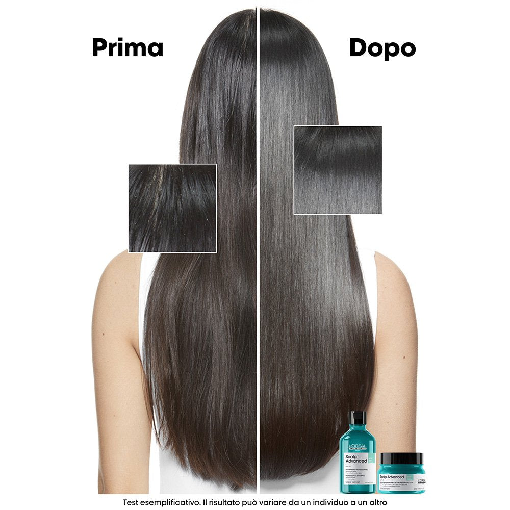 L'Oréal Scalp Advanced 2-in-1 Deep Purifier Clay — maschera purificante all'argilla 250 ml