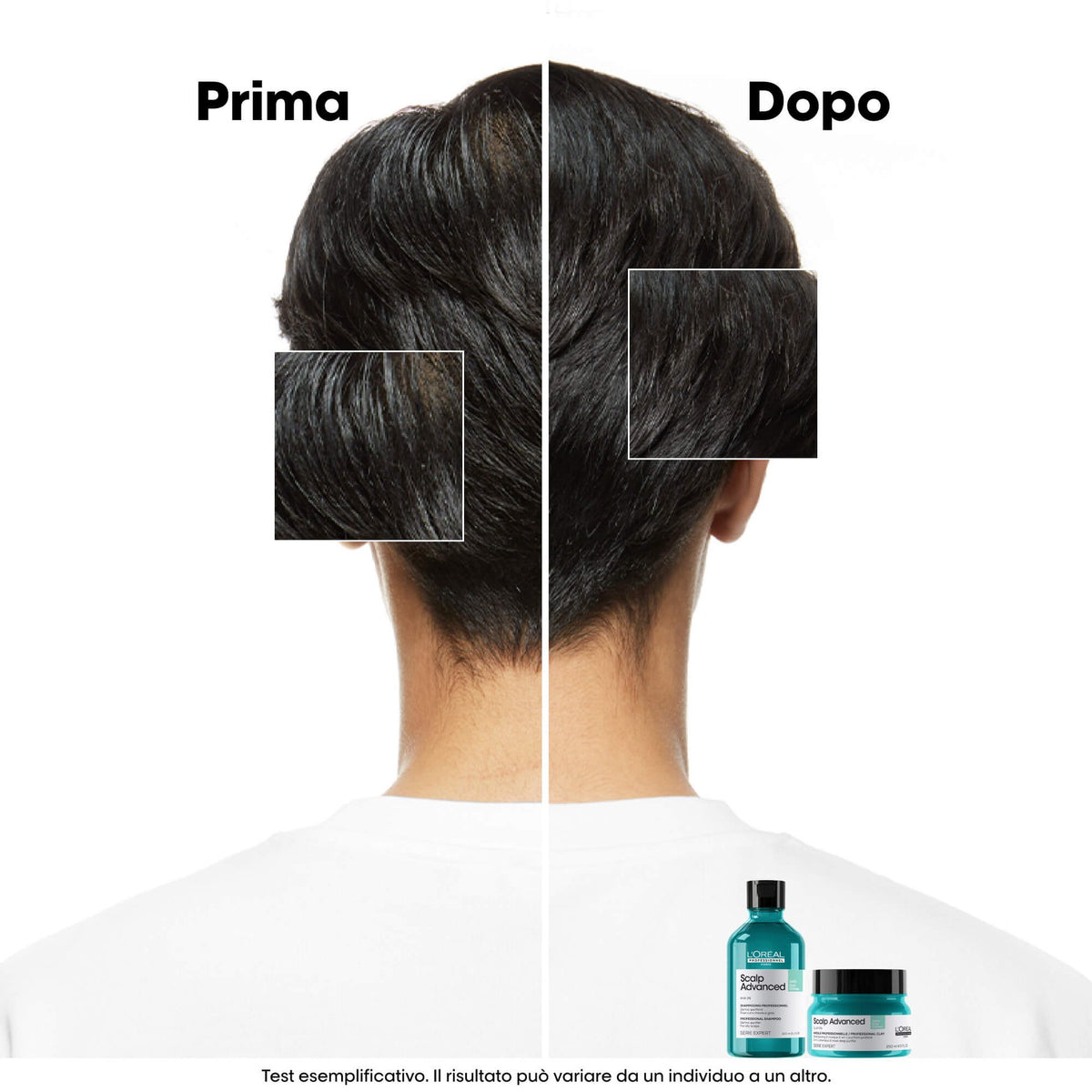 L'Oréal Scalp Advanced Anti-Oiliness — shampoo dermo-purificante 500 ml